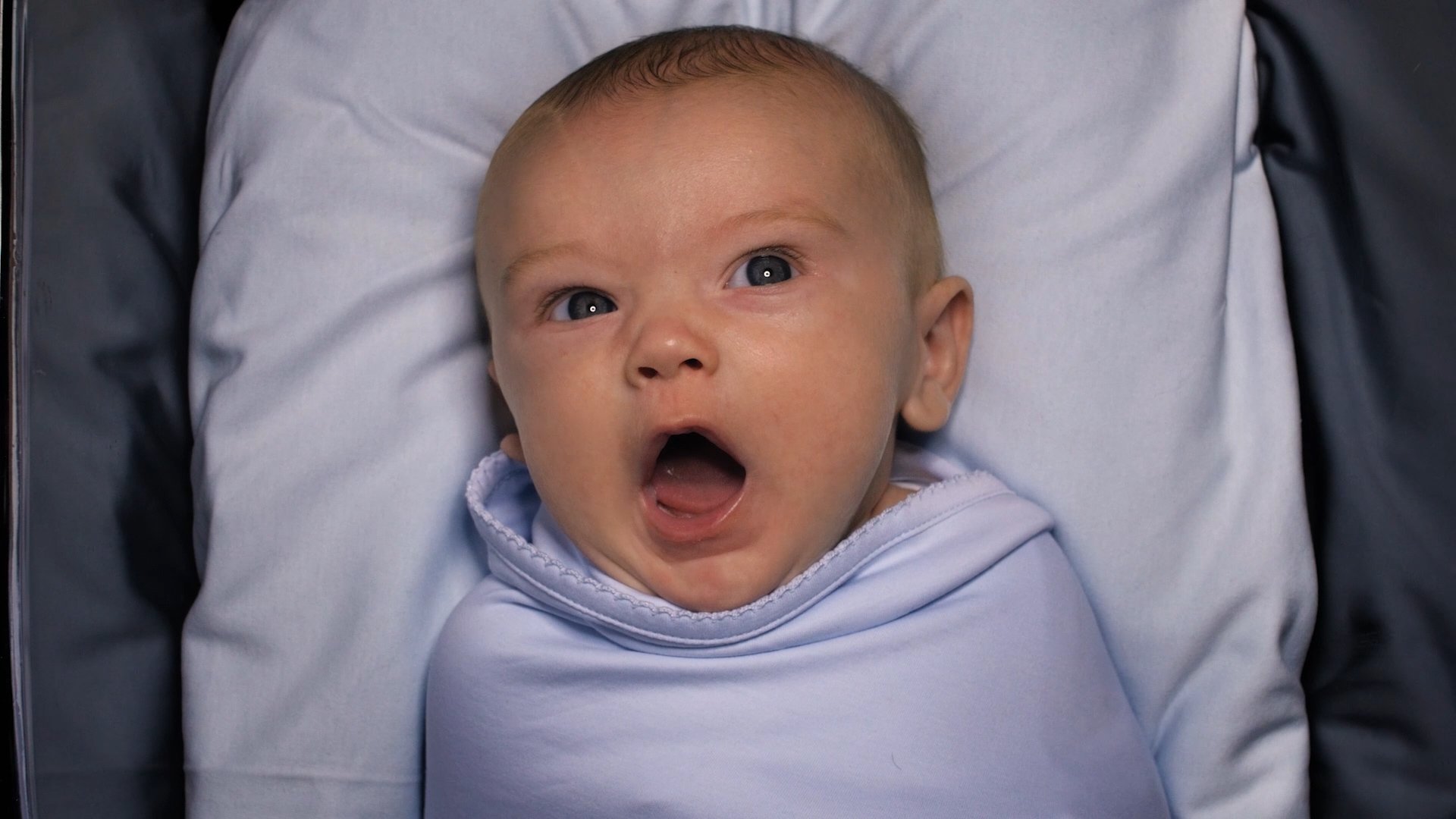 American Circumcision Background